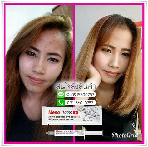 💧 (‼️พร้อมส่ง ของแท้💯% จากตัวแทน‼️) 👉(ราคาตามที่บริษัทกำหนด) ‼️โปรดระวังสินค้าลอกเลียนแบบ‼️ เซรั่มเฌอร์ลิน cherlyn intensive hya booster white serum เซรั่มไฮยา เซรั่ม. เซรั่มเมโซหน้าใส BY FERN MEZZO 100% ส่ง XX LINE : @a0915600757