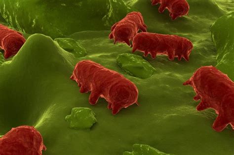 While some of the infections can be easily treated, some of. Investigation started after more than 20 people diagnosed ...