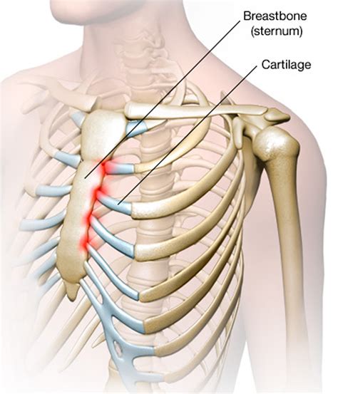 Picture Of What Is Under Your Rib Cage Sternum Pain Causes And When