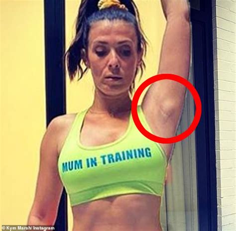kym marsh gets armpit lump check after fans concern over photo daily mail online