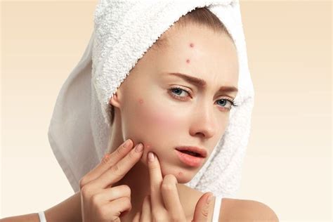 How To Get Rid Of Acne Scabs When Youve Popped A Pimple Organic