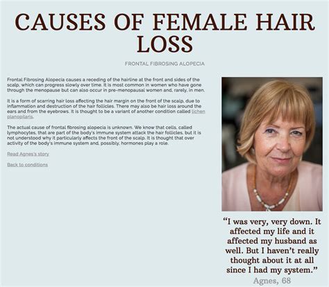 It is primarily used in a hospital setting to manage diabetes mellitus type 2. Find out about Frontal Fibrosing Alopecia and scarring ...