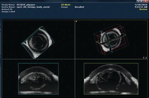 A Brief Overview Of Ophthalmic Ultrasound Imaging Intechopen