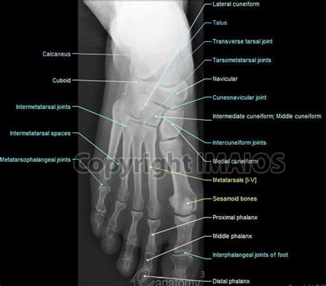 It is performed to look for evidence of injury (or pathology) affecting the foot, often after trauma. The 8 best Foot x ray images on Pinterest | Human anatomy ...