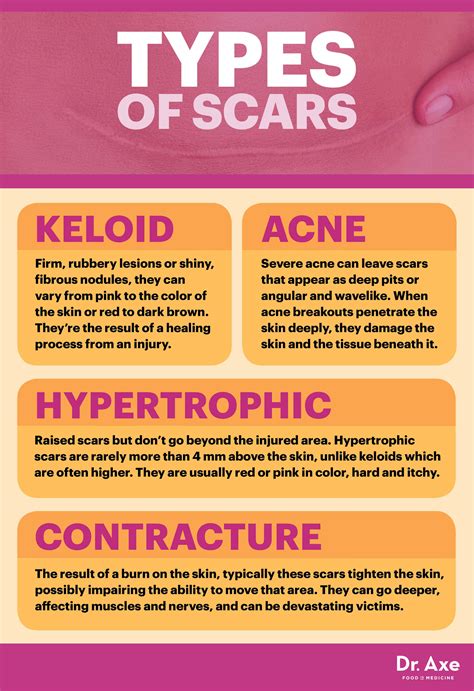 There are many ways for removing acne scars at home by using vegetables, fruits and many more. 8 Secrets on How to Get Rid of Scars - Dr. Axe