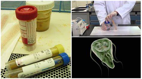 Диета этапы калькулятор Анализ кала на лямблии – описание методов, цены, где сдать, расшифровка Анализ кала на лямблии – описание методов, цены, где сдать, расшифровка Диета этапы калькулятор