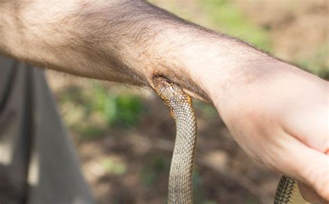 Check spelling or type a new query. Research for Snake Bites | Charity & Nonprofit ...