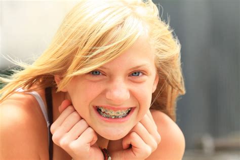 Invisalign vs Braces - Kidtastic Pediatric Dental & Orthodontics | City ...