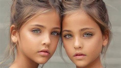 They Were Called The World S Most Beautiful Twins Years Ago Now