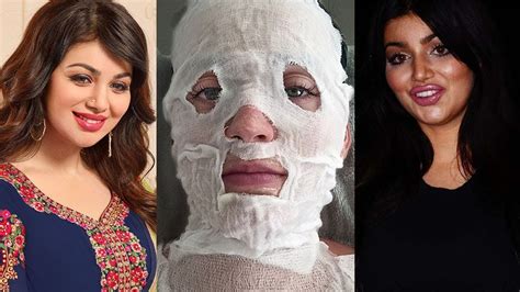 Top 8 Bollywood Actress Plastic Surgery Before And After Gone Horribly Wrong Youtube