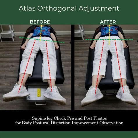 Chiropractic Adjustment Before And After