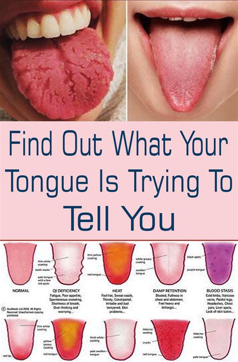 Ipage Toenail Fungus Home Remedies Healthy Brain Tongue