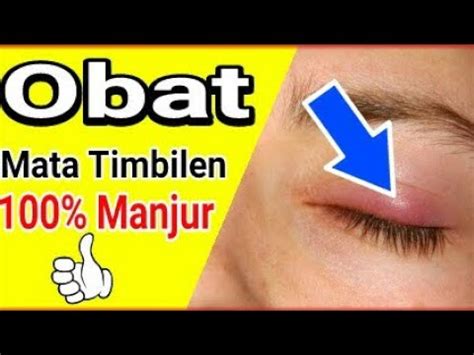 Bagan kaki refleksologi adalah alat yang umum digunakan dalam pengobatan dengan refleksologi yang menjadi semakin populer untuk mengurangi rasa sakit dan stres. Cara Mengatasi Mata Timbilan Dengan Cepat - Terkait Mata