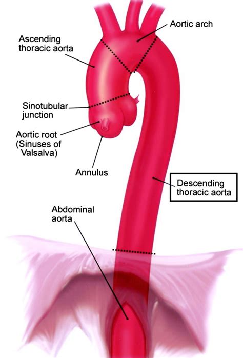 Radiological Anatomy Descending Thoracic Aorta Stepwards