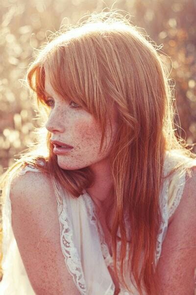 Persistent Redness Beautiful Freckles Redhead Beauty Red Hair