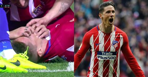 Swallowed Tongue The Truth About Fernando Torres Injury Sportsmanor