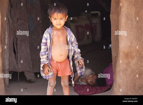 Poor Children Hi Res Stock Photography And Images Alamy
