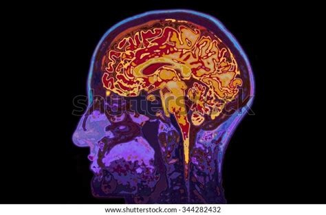 Mri Image Head Showing Brain Stock Photo Edit Now 344282432