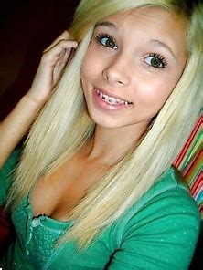 Braces Pictures Search 570 Galleries Page 2