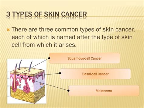 What Different Types Of Skin Cancer Is There Best Home Design Ideas