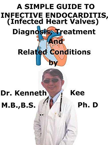 A Simple Guide To Infective Endocarditis Infected Heart Valves