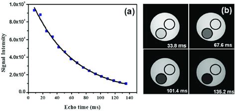 A Magnetic Resonance Imaging Mri Signal Intensity At Different Echo