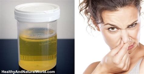Bad Smelling Urine Causes Treatments And When To See A Doctor