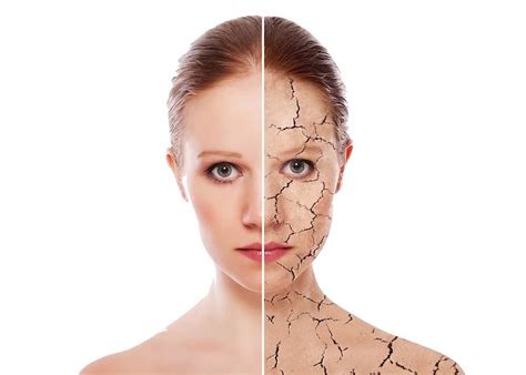 Treating Dry Skin Understanding The Causes Of Dry Skin