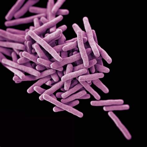 Latent tb infection is diagnosed by detecting specific immunological responses to mycobacterium tuberculosis (mtb) proteins using interferon. Mycobacterium tuberculosis - wikidoc