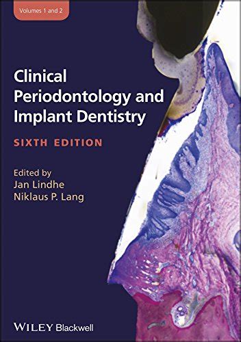 Clinical Periodontology And Implant Dentistry 2 Volume Set English