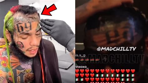 Ix Ine Exposes His Real Hairline Ix Ine Balding Youtube