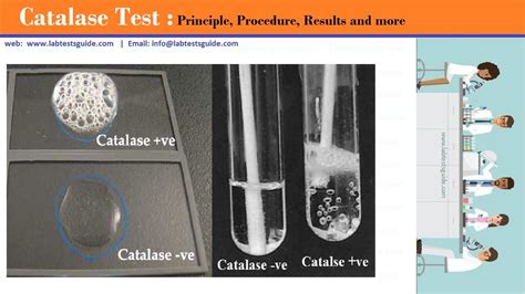 Catalase Test Principle Procedure Results And More Lab Tests Guide