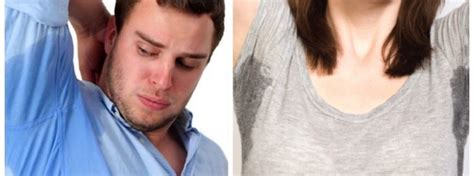 hyperhidrosis sweaty armpits macs cosmetic clinic