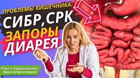 Диарея, запоры, СРК, СИБР и не только: симптомы болезней кишечника и их Картинка - Диарея, запоры, СРК, СИБР и не только: симптомы болезней кишечника и их