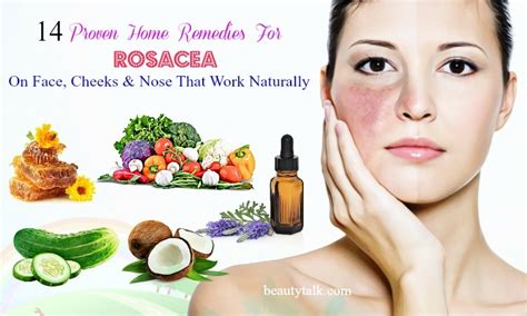 14 Proven Home Remedies For Rosacea On Face Cheeks And Nose