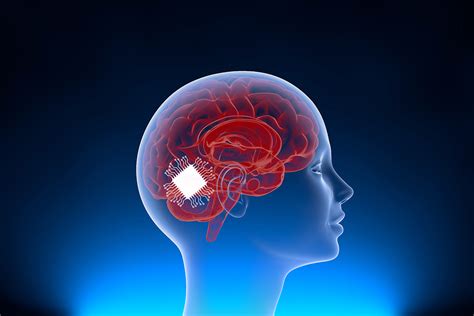Darpa Developed A Brain Zapping Prosthesis That Improves Memory By 50