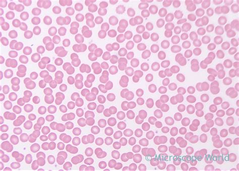 Human Blood Cells Under Microscope 400x Micropedia