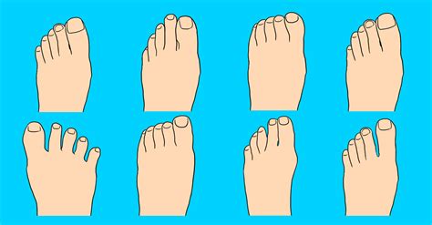 The Shape Of Your Toes Can Reveal Interesting Secrets About Your