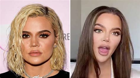 Khloé Kardashian Opens Up About The Plastic Surgery Behind Her ‘new Face’