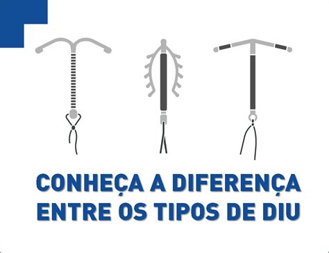 Qual O Hormonio Do Diu Mirena
