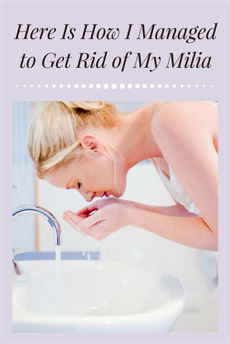 Here Is How I Managed To Get Rid Of My Milia With Natural Products