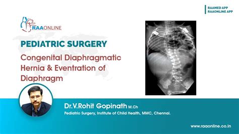 Congenital Diaphragmatic Hernia And Eventration Of Diaphragm Youtube