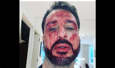 Fabrizio Corona deve tornare in carcere, si ferisce alle ...