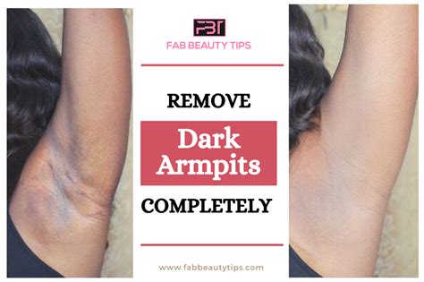 Get Rid Of Dark Armpits In A Week Fab Beauty Tips Dark Armpits