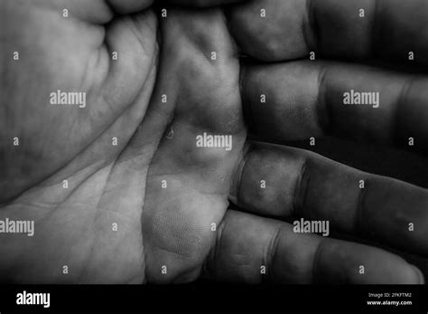 Withered Hand High Resolution Stock Photography And Images Alamy