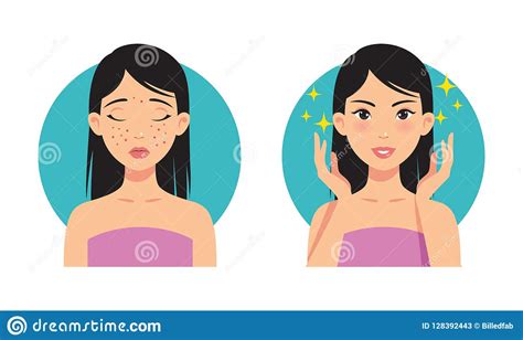 Illustration Before And After Facial Acne Treatment From A Beautiful
