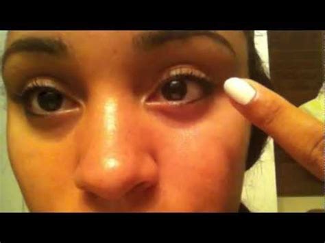 Why do animals twitch in their sleep? My Twitching Eye make it stopppp!! =[ - YouTube