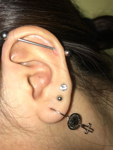 Irritation Bump Or Keloid Ive Had My Industrial Piercing For About 2 Years Now Its Fully