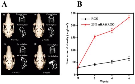 Materials Free Full Text Osteogenic Potential Of Graphene In Bone
