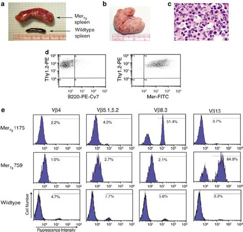 Mer Tg Mice Develop Clonal T Cell Lymphomas A Massive Splenomegaly